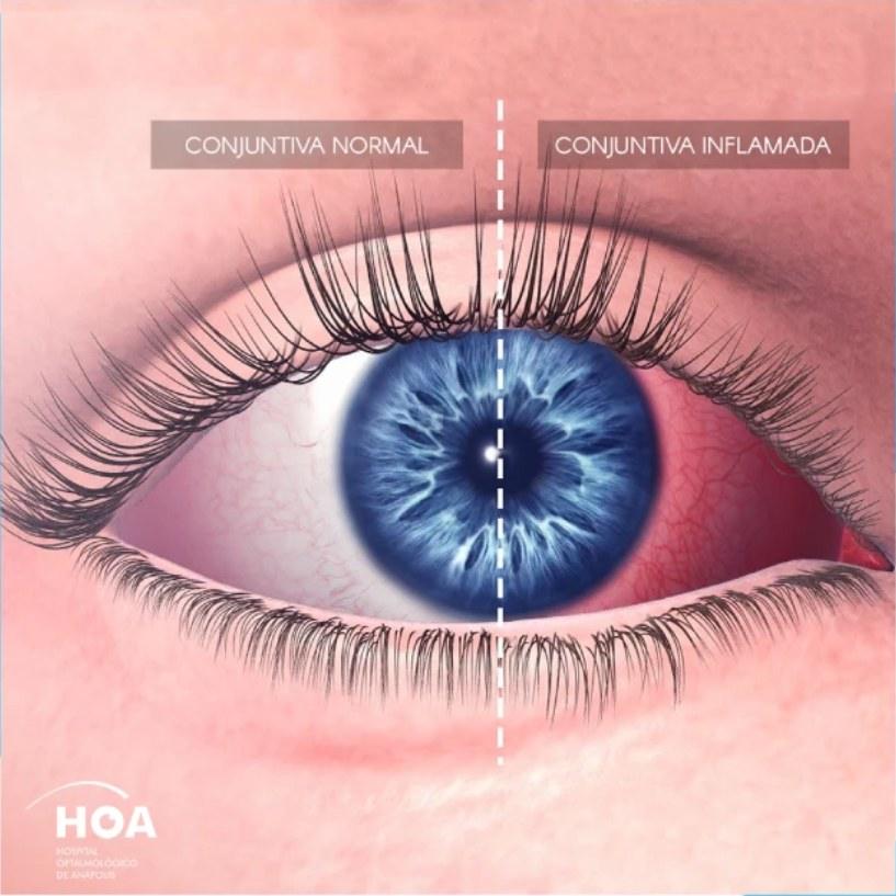 HOA — peça 4